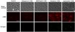 Collagen I Antibody in Immunocytochemistry (ICC/IF)