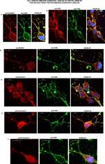 BACE1 Antibody in Immunocytochemistry (ICC/IF)