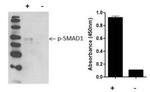 Human SMAD1 (Phospho) [pS463/pS465] InstantOne™ ELISA Kit