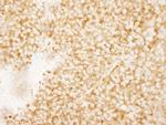 rpL7a/SURF3 Antibody in Immunohistochemistry (IHC)