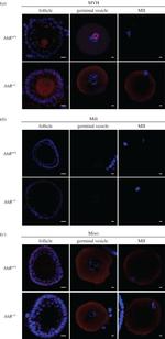 PIWIL1 Antibody in Immunohistochemistry (Paraffin) (IHC (P))