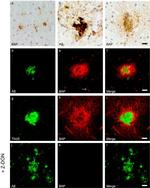 beta Amyloid Antibody in Immunohistochemistry (Frozen) (IHC (F))