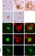 beta Amyloid Antibody in Immunohistochemistry (Frozen) (IHC (F))