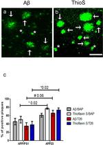 beta Amyloid Antibody in Immunocytochemistry (ICC/IF)