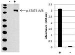 Human STAT5 alpha/beta (Phospho) [pY694/pY699] InstantOne™ ELISA Kit