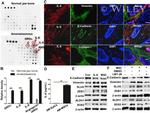 IL-6 Antibody in Immunohistochemistry (IHC)