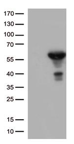 ALDH1A3 Antibody in Western Blot (WB)