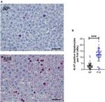 Ki-67 Antibody in Immunohistochemistry (IHC)