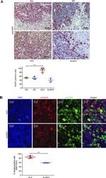 Ki-67 Antibody in Immunohistochemistry (IHC)