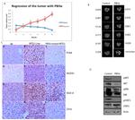 VEGF Receptor 3 Antibody in Immunohistochemistry, Immunohistochemistry (Paraffin) (IHC, IHC (P))