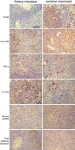 IL-17A Antibody in Immunohistochemistry (IHC)