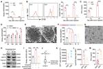 IFN gamma Antibody in ELISA (ELISA)