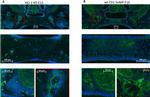 CXCR4 Antibody in Immunohistochemistry (IHC)