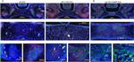 CXCR4 Antibody in Immunohistochemistry (IHC)