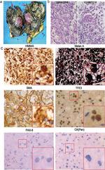 Alpha-Smooth Muscle Actin Antibody in Immunohistochemistry (IHC)