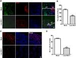 ISL1 Antibody in Immunohistochemistry (IHC)