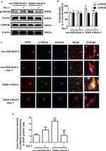 GFAP Antibody in Immunocytochemistry (ICC/IF)