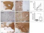 HLA-DR Antibody in Immunohistochemistry (IHC)