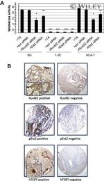 Phospho-ETS2 (Thr72) Antibody in Immunohistochemistry (IHC)