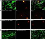 Calcium Sensing Receptor Antibody in Immunohistochemistry (IHC)