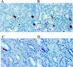 IL-8 (CXCL8) Antibody in Immunohistochemistry (IHC)