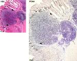 PCNA Antibody in Immunohistochemistry, Immunohistochemistry (Paraffin) (IHC, IHC (P))