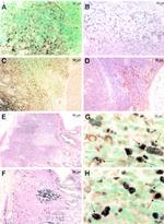 PCNA Antibody in Immunohistochemistry, Immunohistochemistry (Paraffin) (IHC, IHC (P))