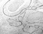 Thrombospondin 1 Antibody in Immunohistochemistry (IHC)