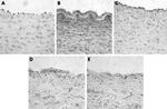 PAR2 Antibody in Immunohistochemistry (IHC)