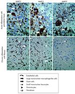 MMP2 Antibody in Immunohistochemistry (IHC)