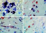 MMP2 Antibody in Immunohistochemistry (IHC)