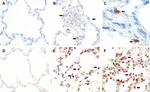 Phospho-STAT1 (Tyr701) Antibody in Immunohistochemistry (IHC)