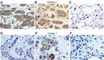 TIMP1 Antibody in Immunohistochemistry (IHC)