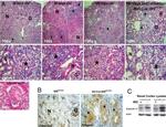 Vimentin Antibody in Immunohistochemistry (IHC)