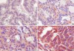 iNOS Antibody in Immunohistochemistry (IHC)