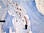 CD34 Antibody in Immunohistochemistry (IHC)