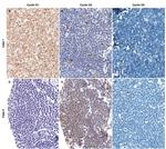 Cyclin D1 Antibody in Immunohistochemistry (IHC)