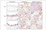 Progesterone Receptor Antibody in Immunohistochemistry (IHC)