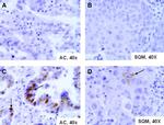 SSTR2 Antibody in Immunohistochemistry (IHC)