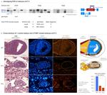 PTBP1 Antibody in Immunohistochemistry (IHC)