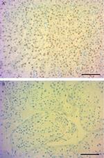 NR5A1 Antibody in Immunohistochemistry (IHC)