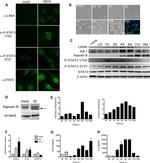 IL-6 Antibody in ELISA (ELISA)