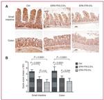 COX2 Antibody in Immunohistochemistry (IHC)