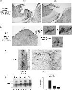 beta Amyloid Antibody in Immunohistochemistry (IHC)