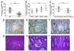 TMPRSS4 Antibody in Immunohistochemistry (IHC)