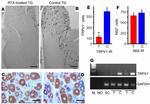 TRPV1 Antibody in Immunohistochemistry (IHC)