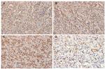 VEGF Receptor 1 (soluble) Antibody in Immunohistochemistry, Immunohistochemistry (Paraffin) (IHC, IHC (P))