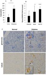 TLR4 Antibody in Immunohistochemistry, Immunohistochemistry (Paraffin) (IHC, IHC (P))