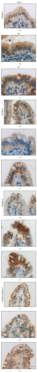 Claudin 3 Antibody in Immunohistochemistry, Immunohistochemistry (Paraffin) (IHC, IHC (P))