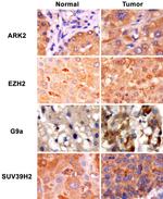 EZH2 Antibody in Immunohistochemistry, Immunohistochemistry (Paraffin) (IHC, IHC (P))